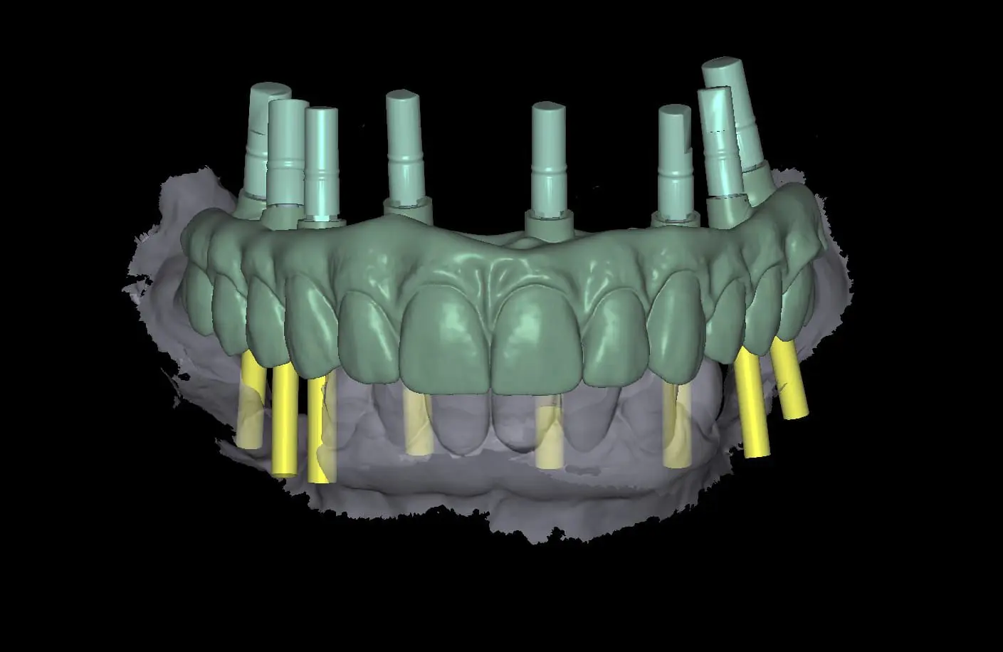 Laboratorio Digital CAD/CAM